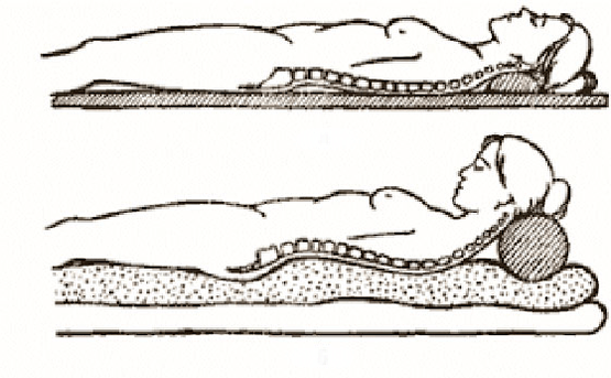 Figura de la osteocondrosis