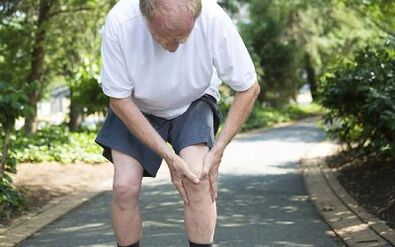 Cómo se manifiesta la artrosis de la articulación de la rodilla